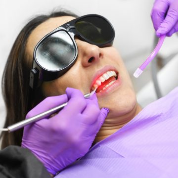 Demystifying Laser Gum Surgery: What You Need to Understand